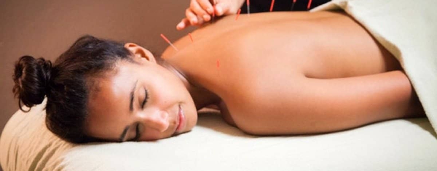 Acupuntura é eficaz para amenizar todos os tipos de estresse
