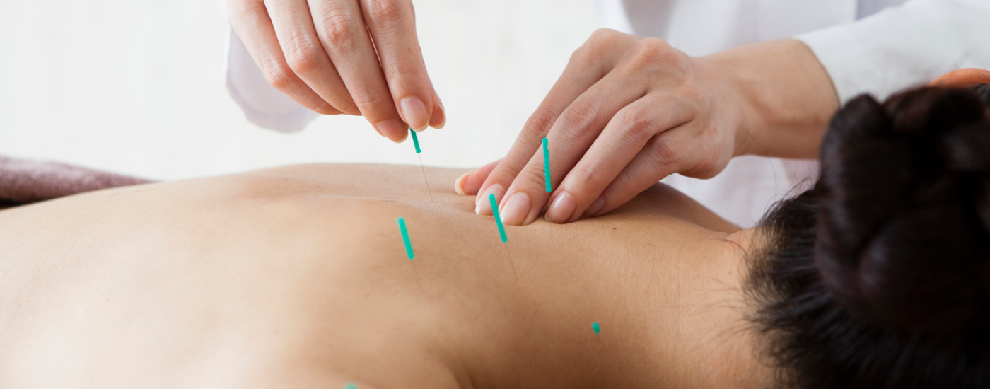 Acupuntura: atendimento domiciliar traz ainda mais benefícios