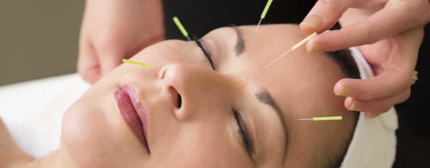 Acupuntura alivia dor causada por disfunção musculoesquelética