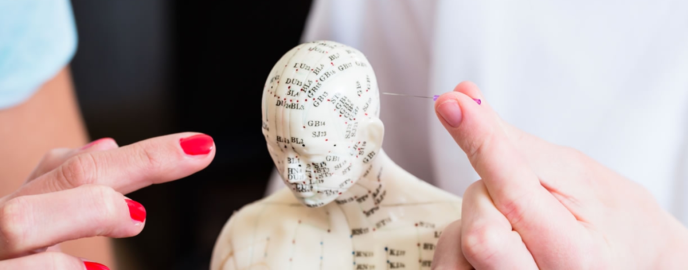 Acupuntura: a medicina milenar